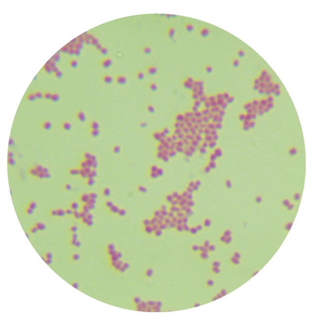 Escherichia coli-BNCC