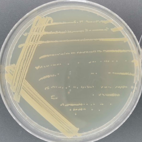 Bacillus johnsonii-BNCC