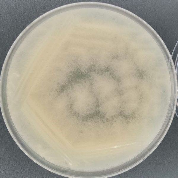 Bacillus subtilis-BNCC
