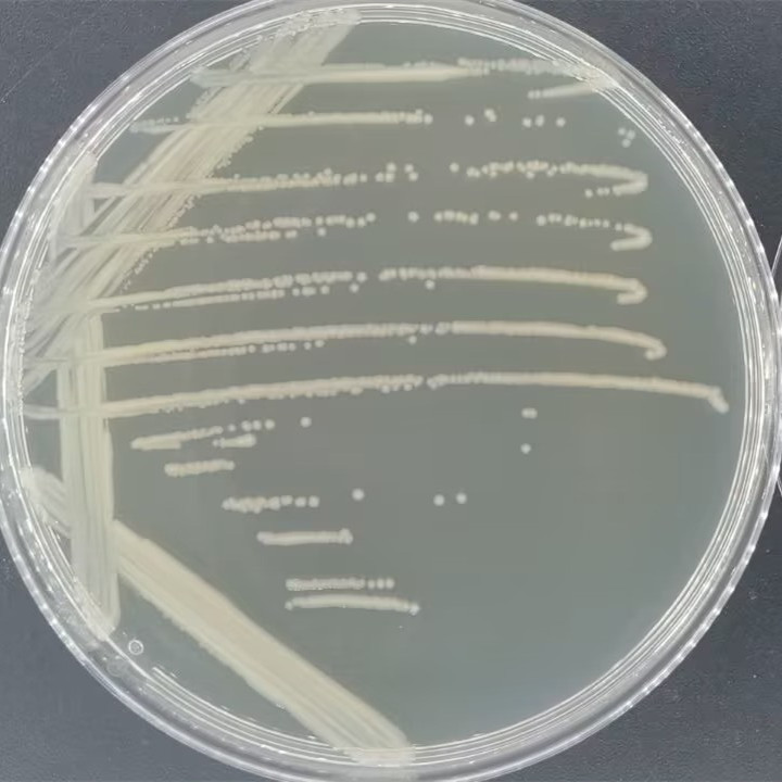Escherichia coli-BNCC