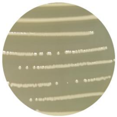 Escherichia coli-BNCC