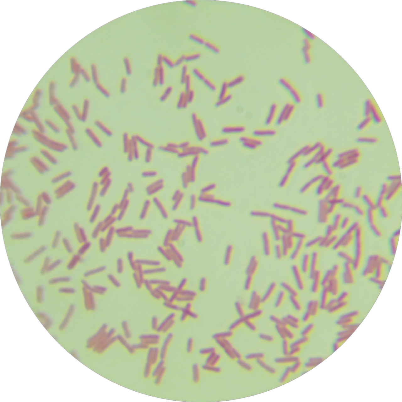 Pseudomonas aeruginosa-BNCC