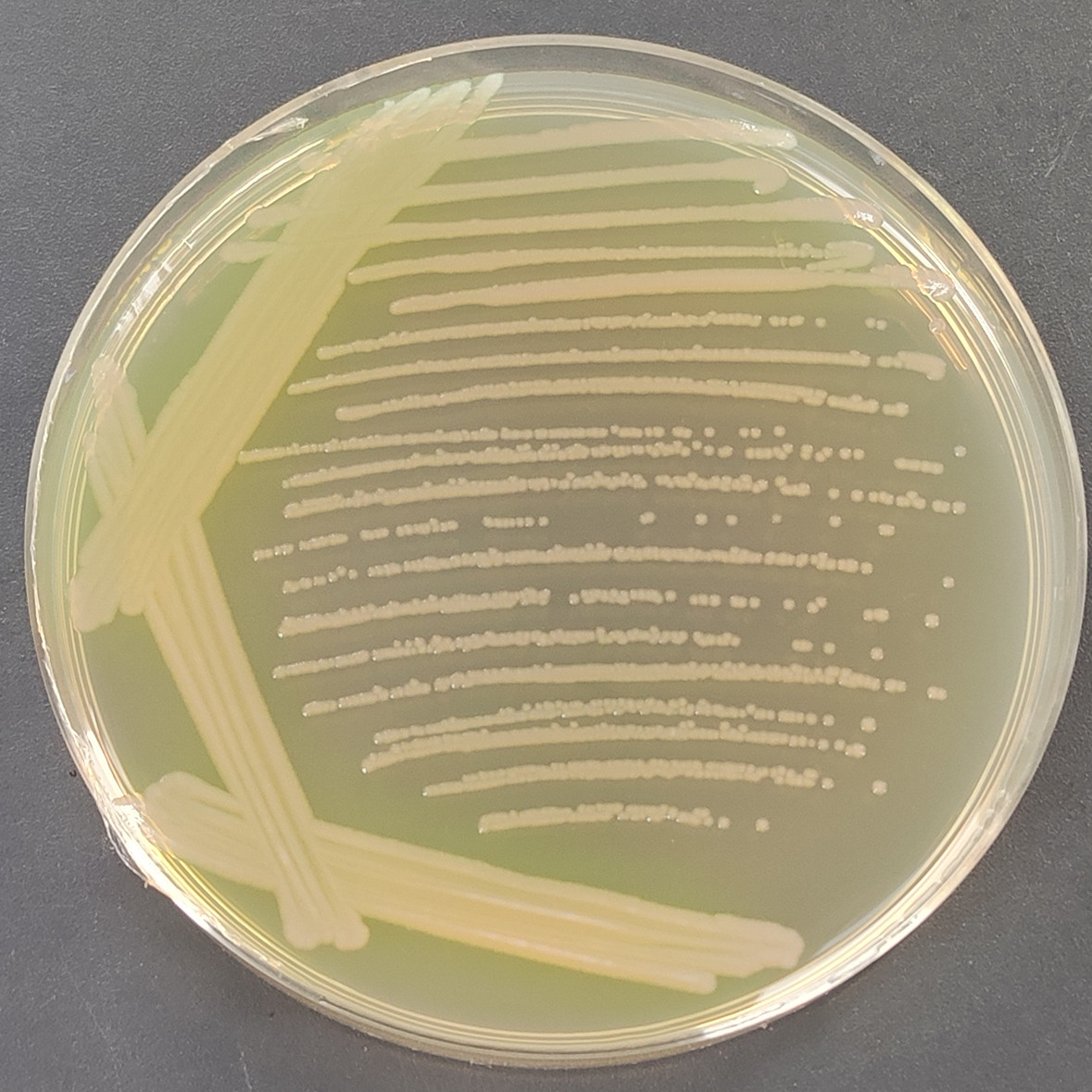 Pseudomonas aeruginosa-BNCC