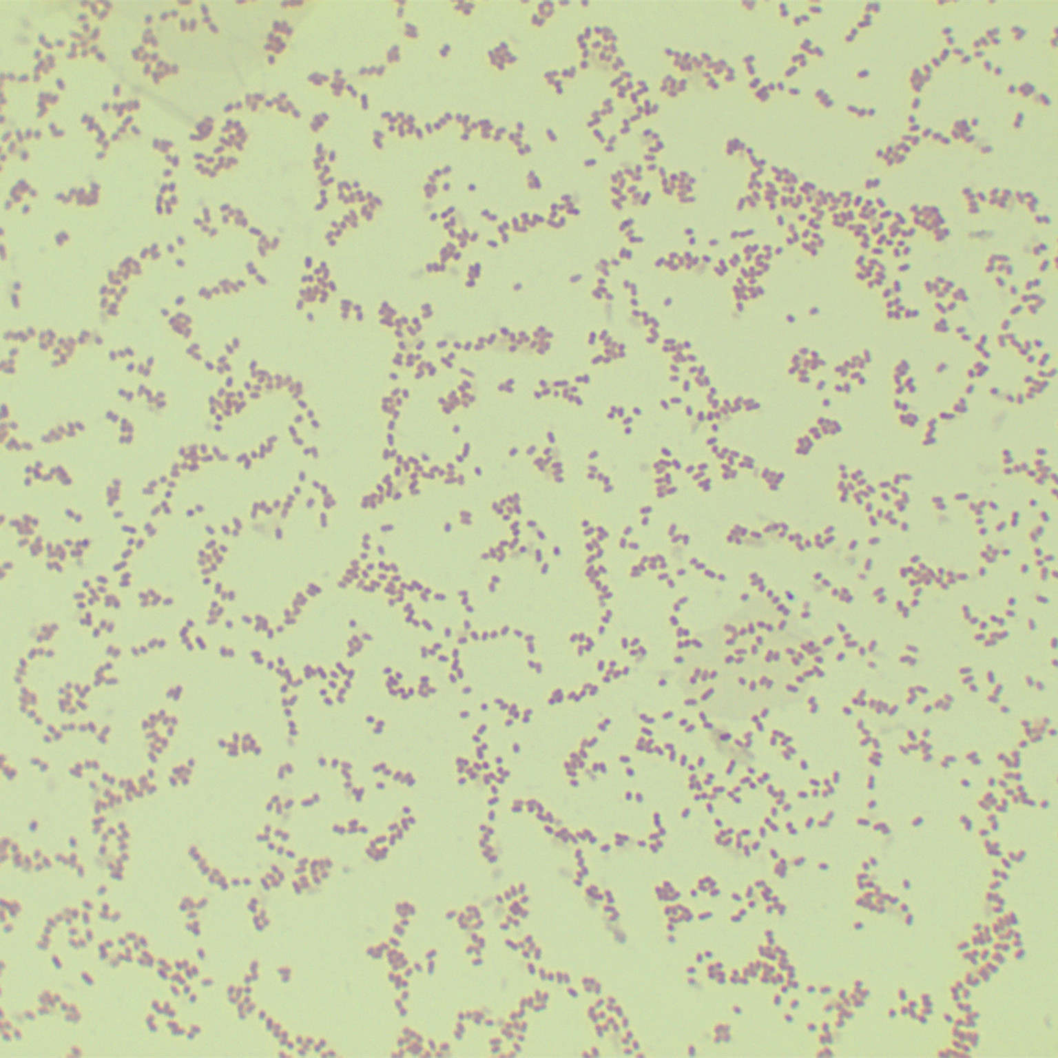 Pseudomonas aeruginosa-BNCC