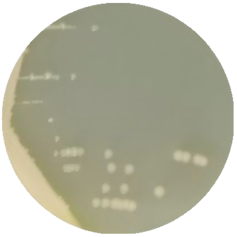 Pseudomonas aeruginosa-BNCC