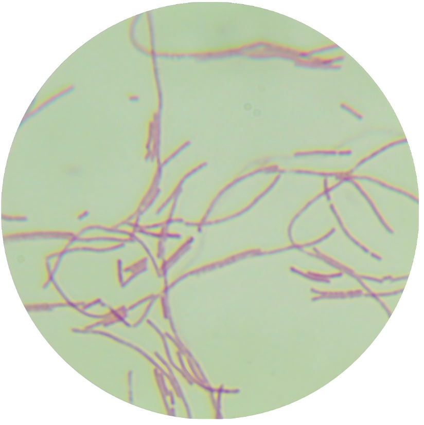 Pseudomonas aeruginosa-BNCC