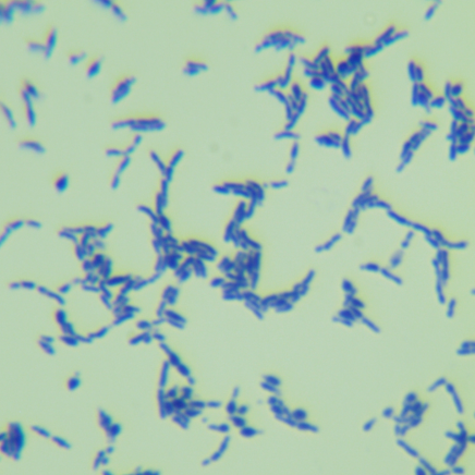 Bifidobacterium longum subsp. suis-BNCC