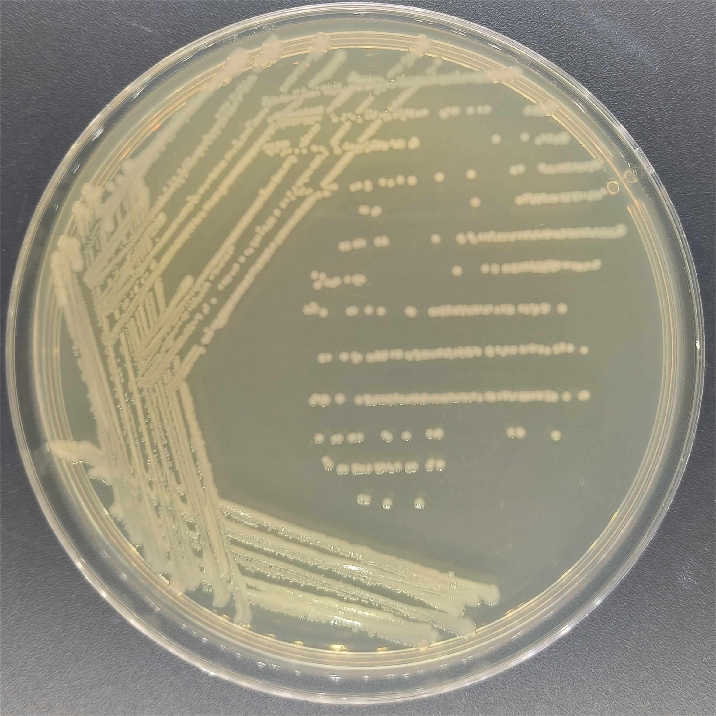 Shigella flexneri-BNCC