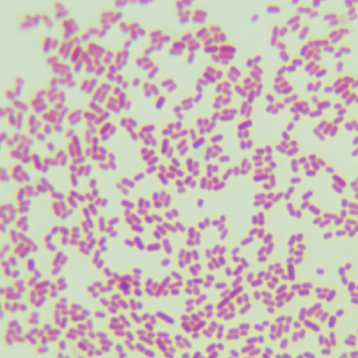 Shigella flexneri-BNCC