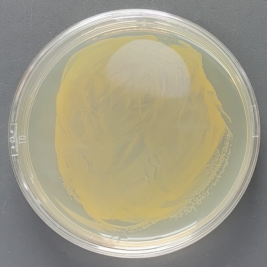 Acetylmicrobacterium-BNCC