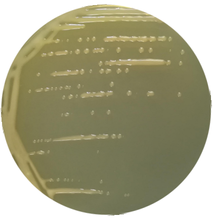 Pseudomonas aeruginosa-BNCC