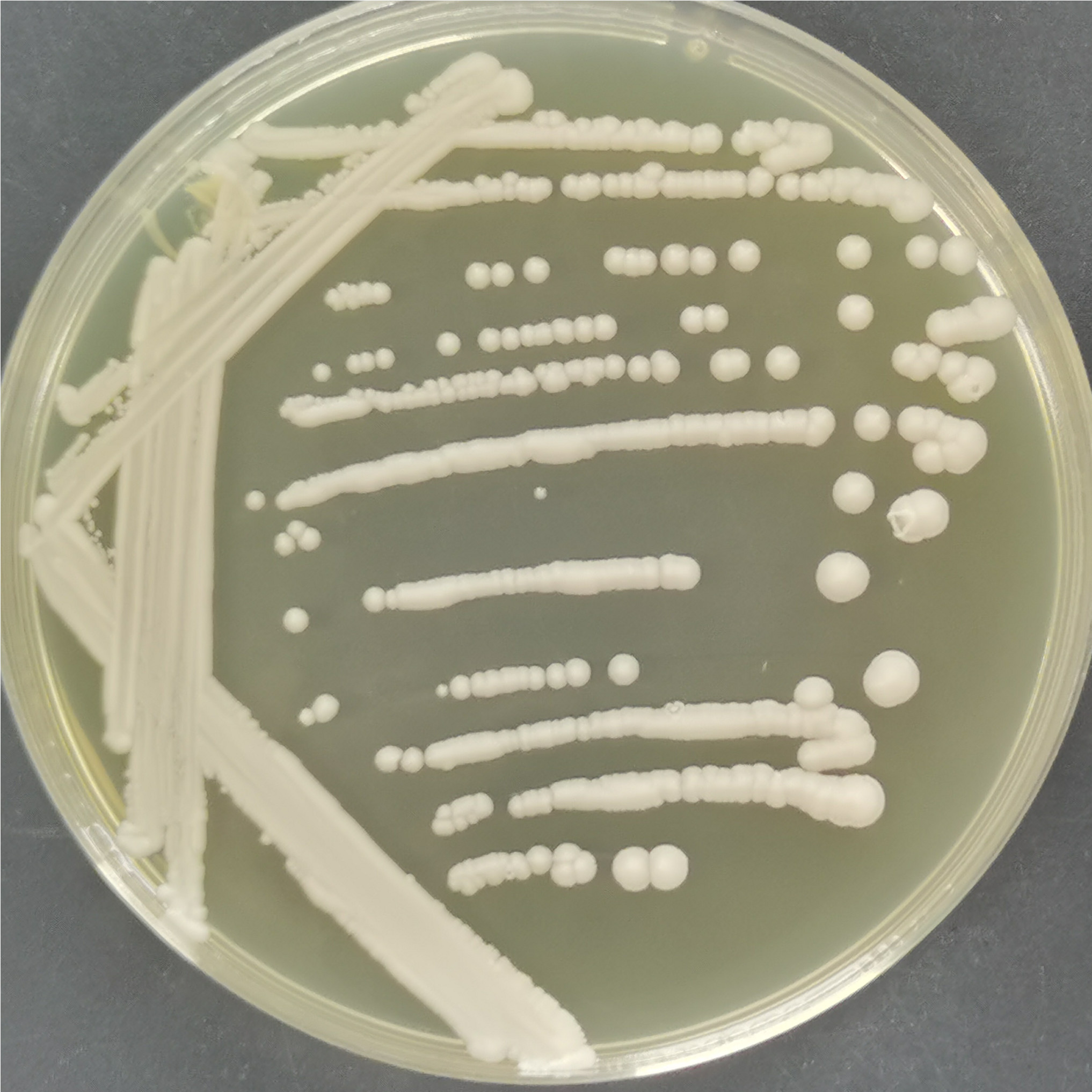 Saccharomyces cerevisiae-BNCC