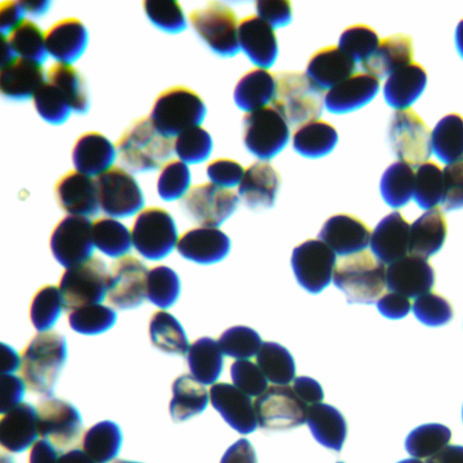 Saccharomyces cerevisiae-BNCC