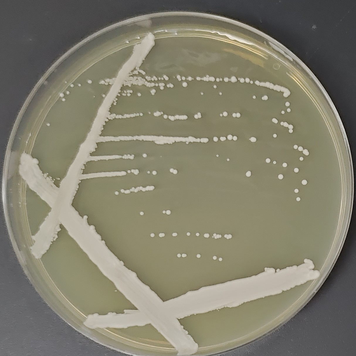 Pasteur Yeast-BNCC