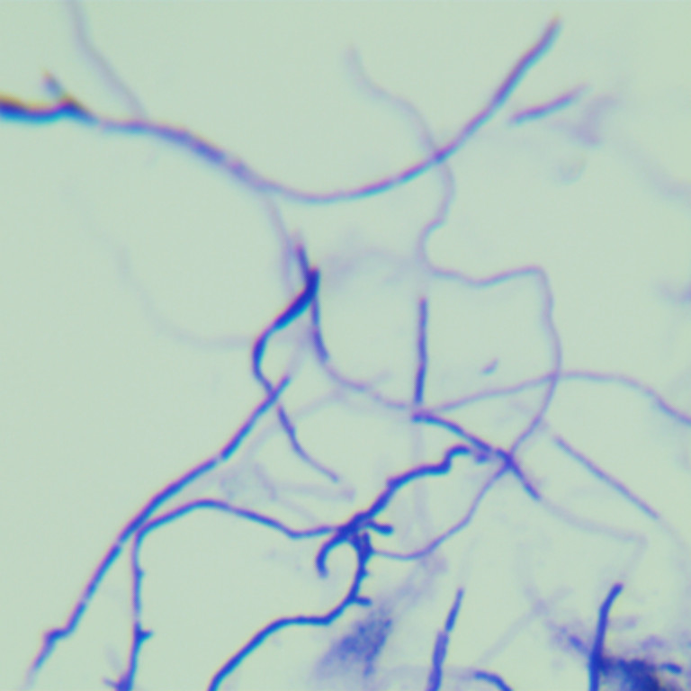 Streptomyces coelicolor-BNCC