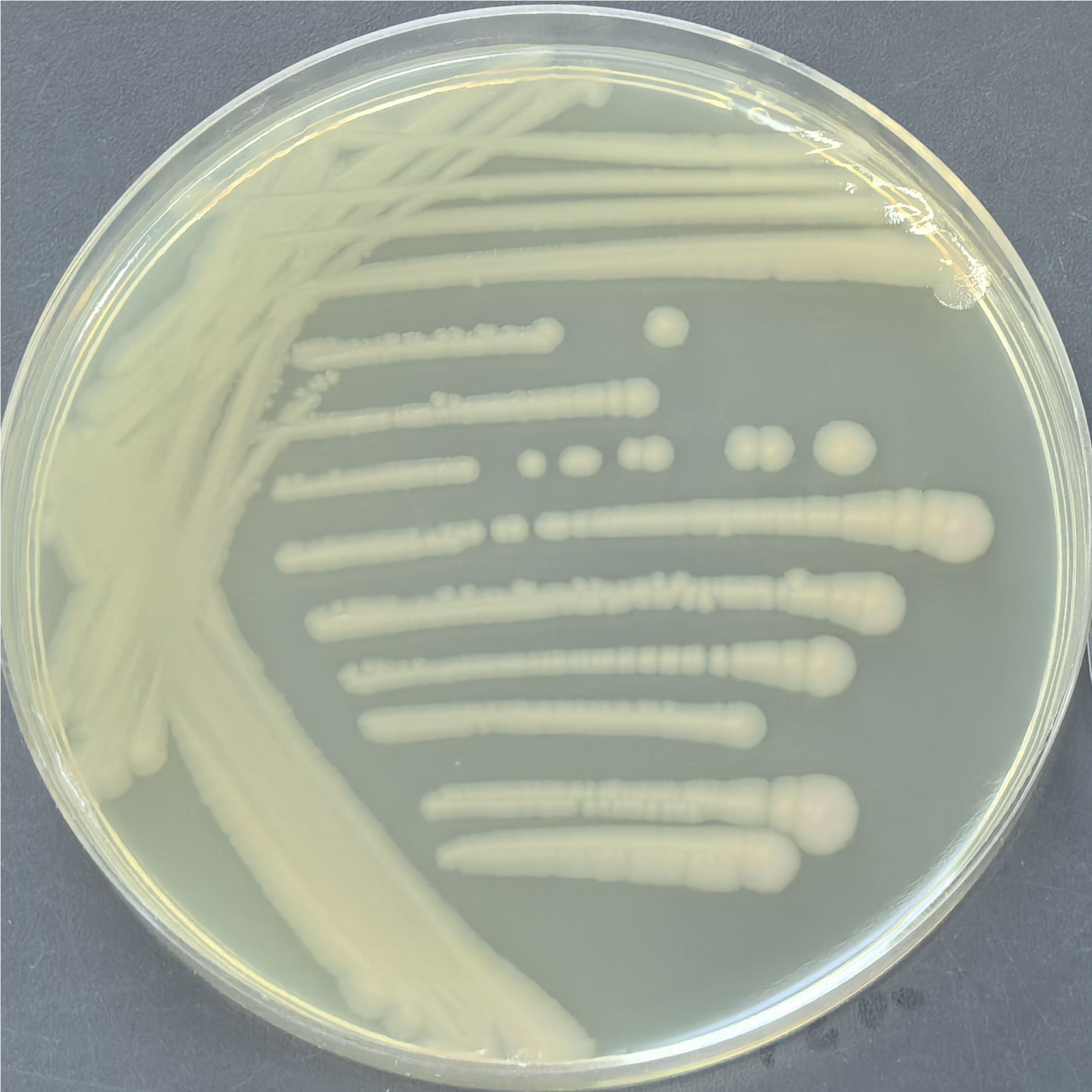 Pseudomonas aeruginosa-BNCC
