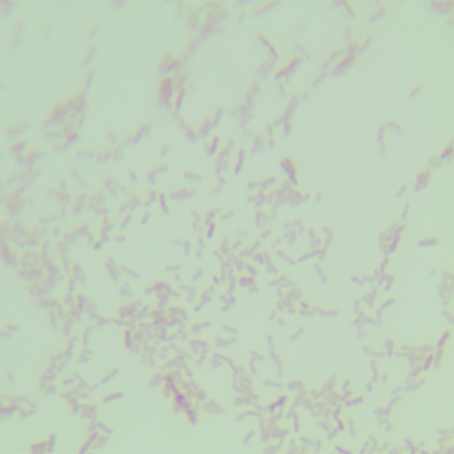 Pseudomonas aeruginosa-BNCC