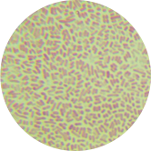 Escherichia coli-BNCC