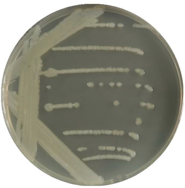 Salmonella enterica serovar Typhimurium-BNCC