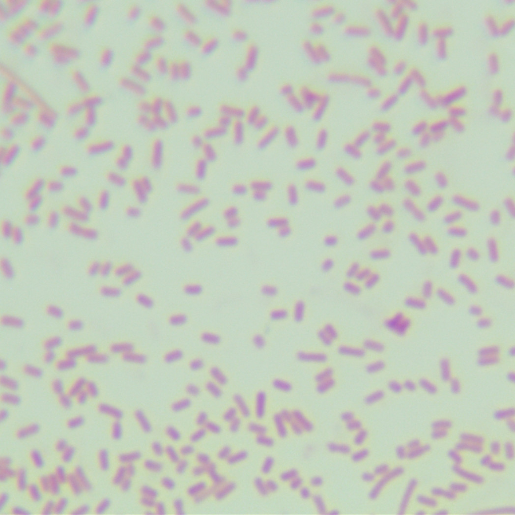 Salmonella enterica serovar Typhimurium-BNCC