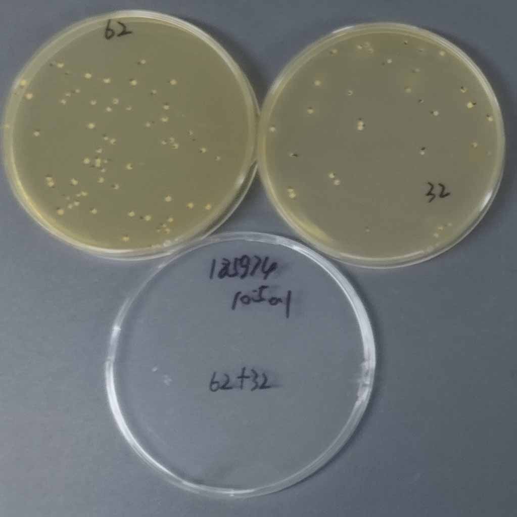 Youthful Bifidobacterium-BNCC