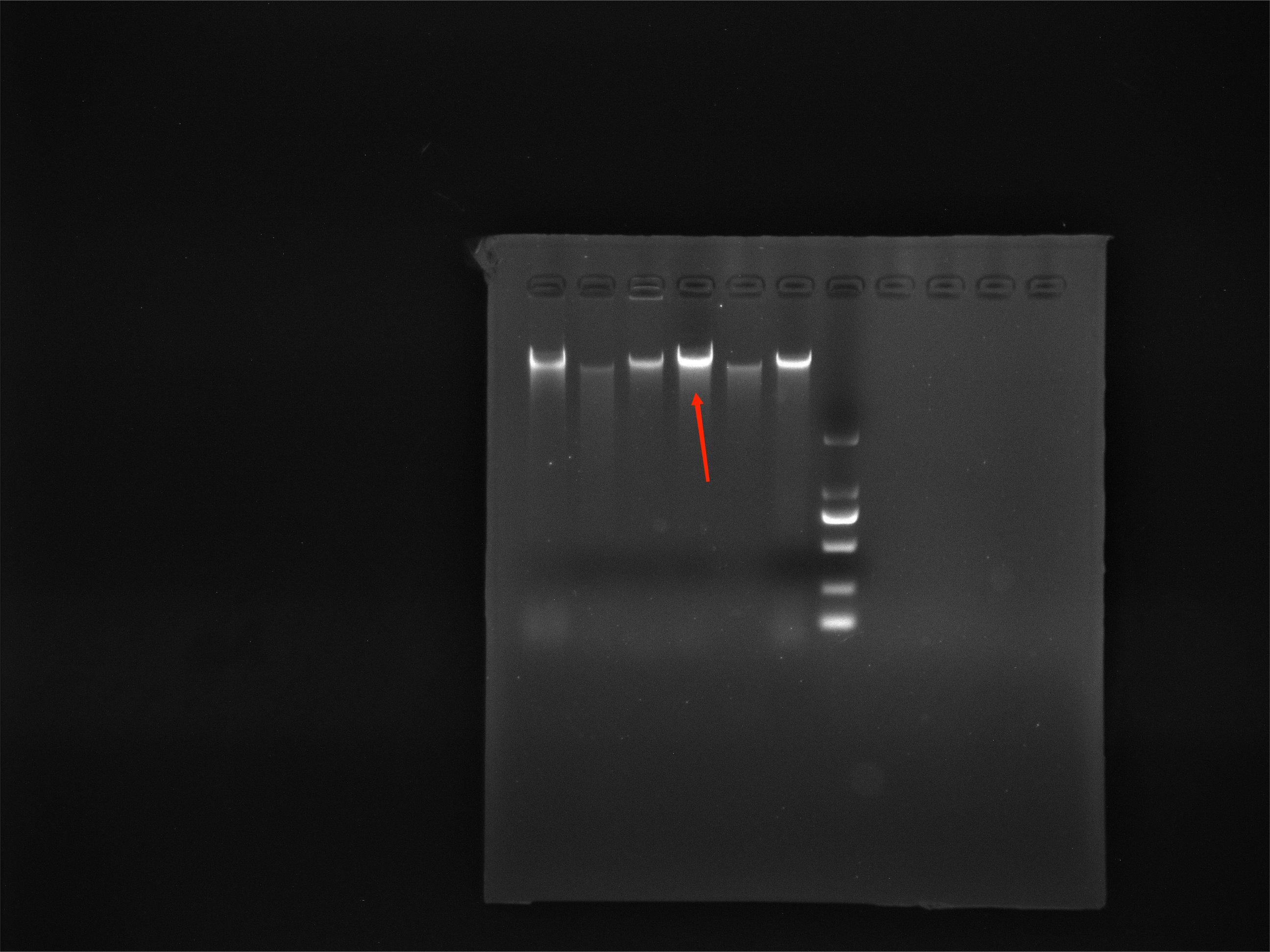 Listeria monocytogenes-BNCC