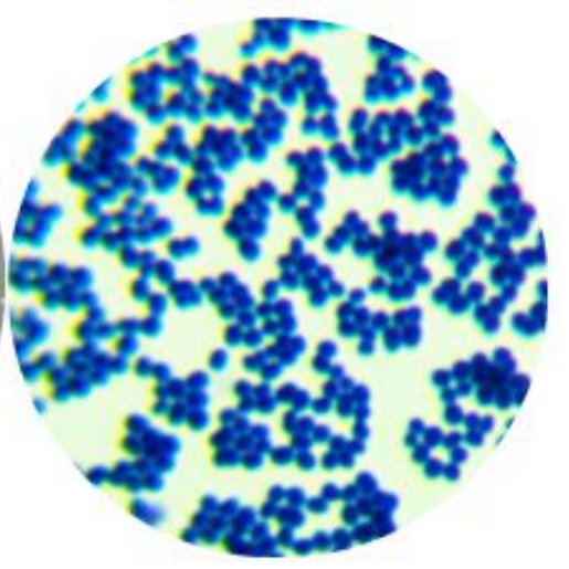 Marsh Kochia-BNCC