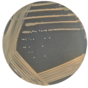 Pseudomonas aeruginosa-BNCC