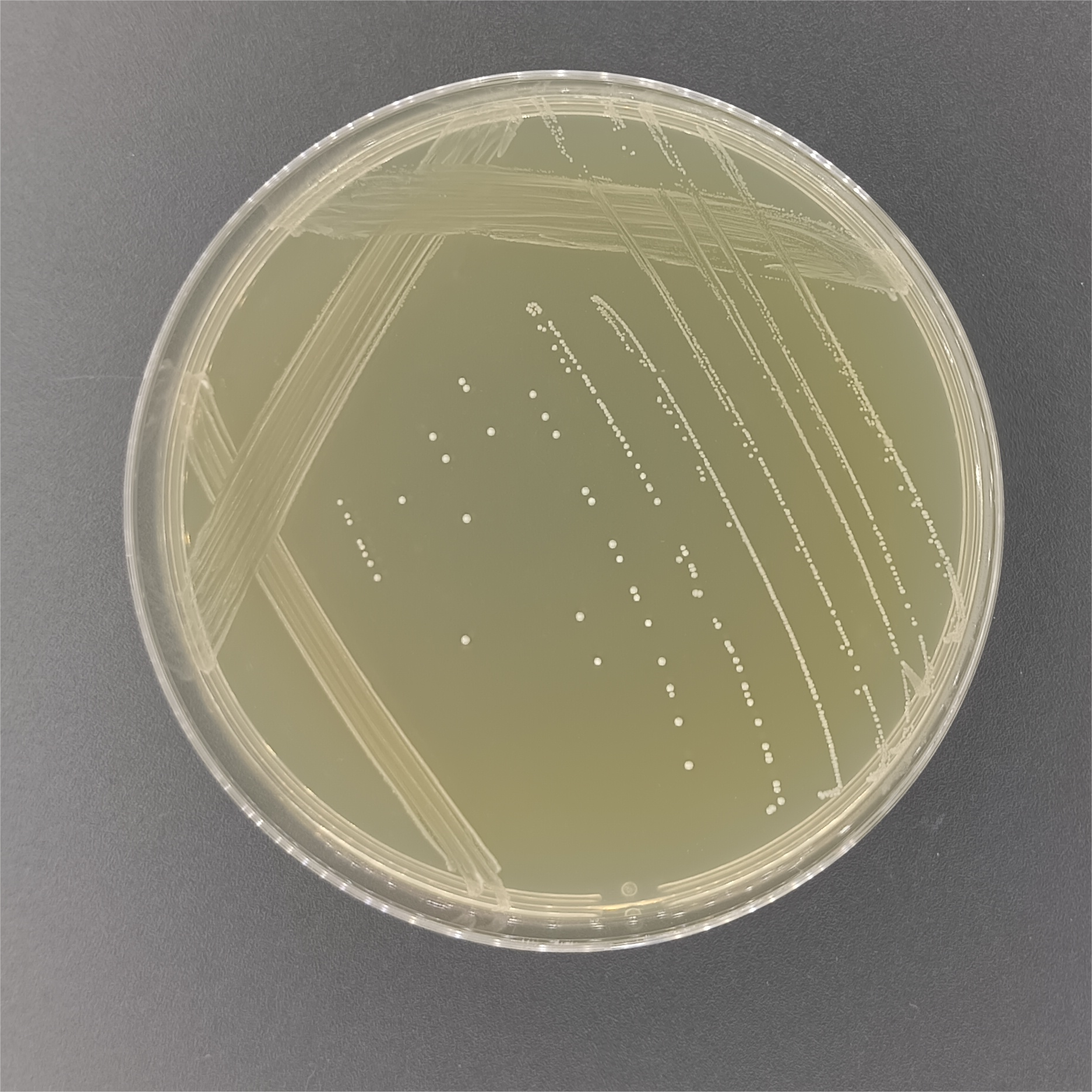Streptococcus bovis-BNCC