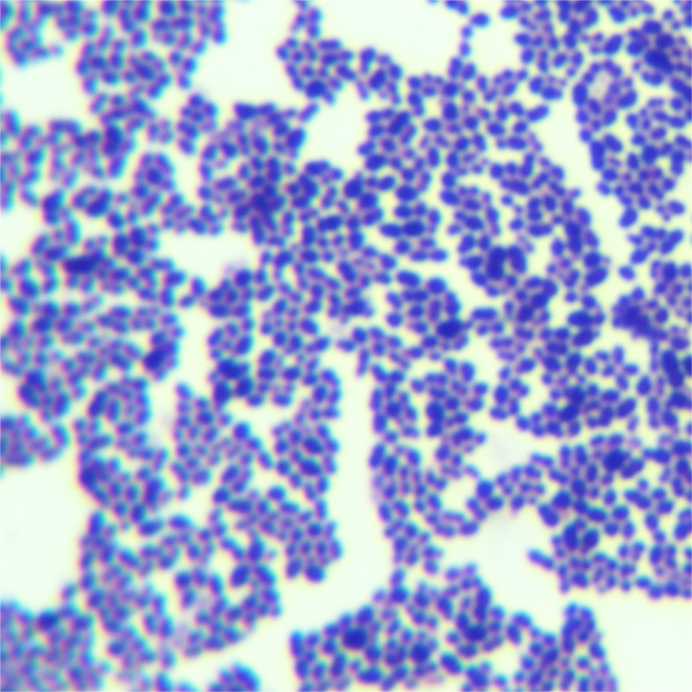 Streptococcus bovis-BNCC