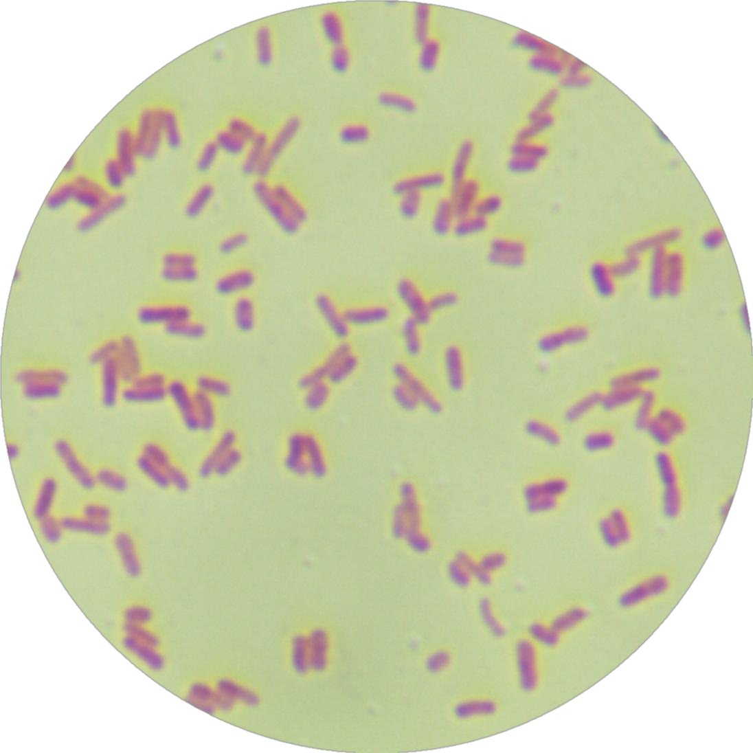 Salmonella enterica subspecies enterica-BNCC