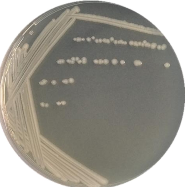 Salmonella enterica subspecies enterica-BNCC