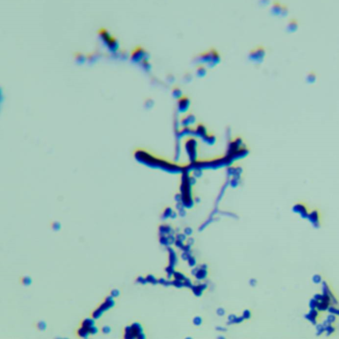 Sugarcane Laissezia-BNCC