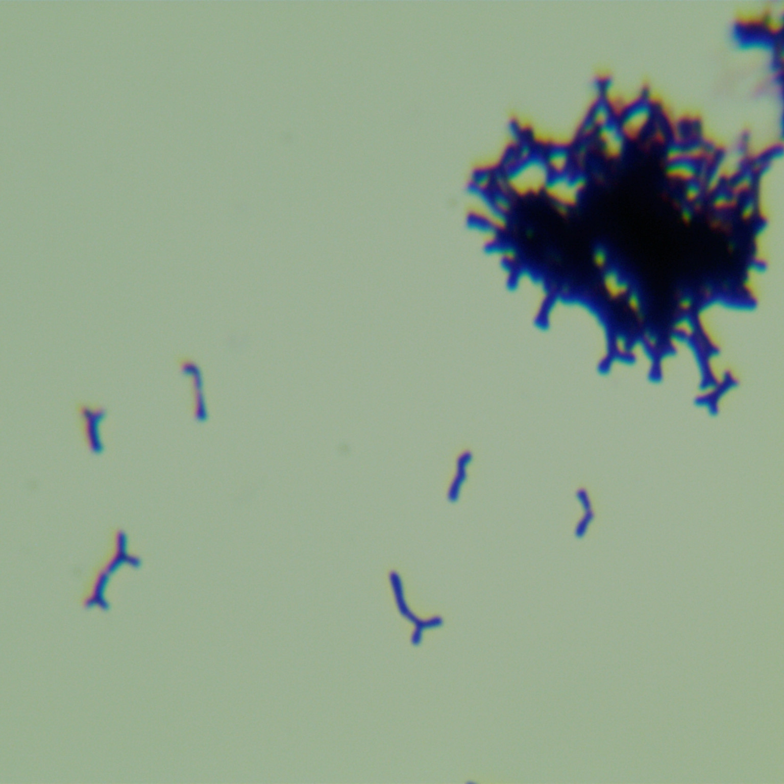 Bifidobacterium bifidum-BNCC