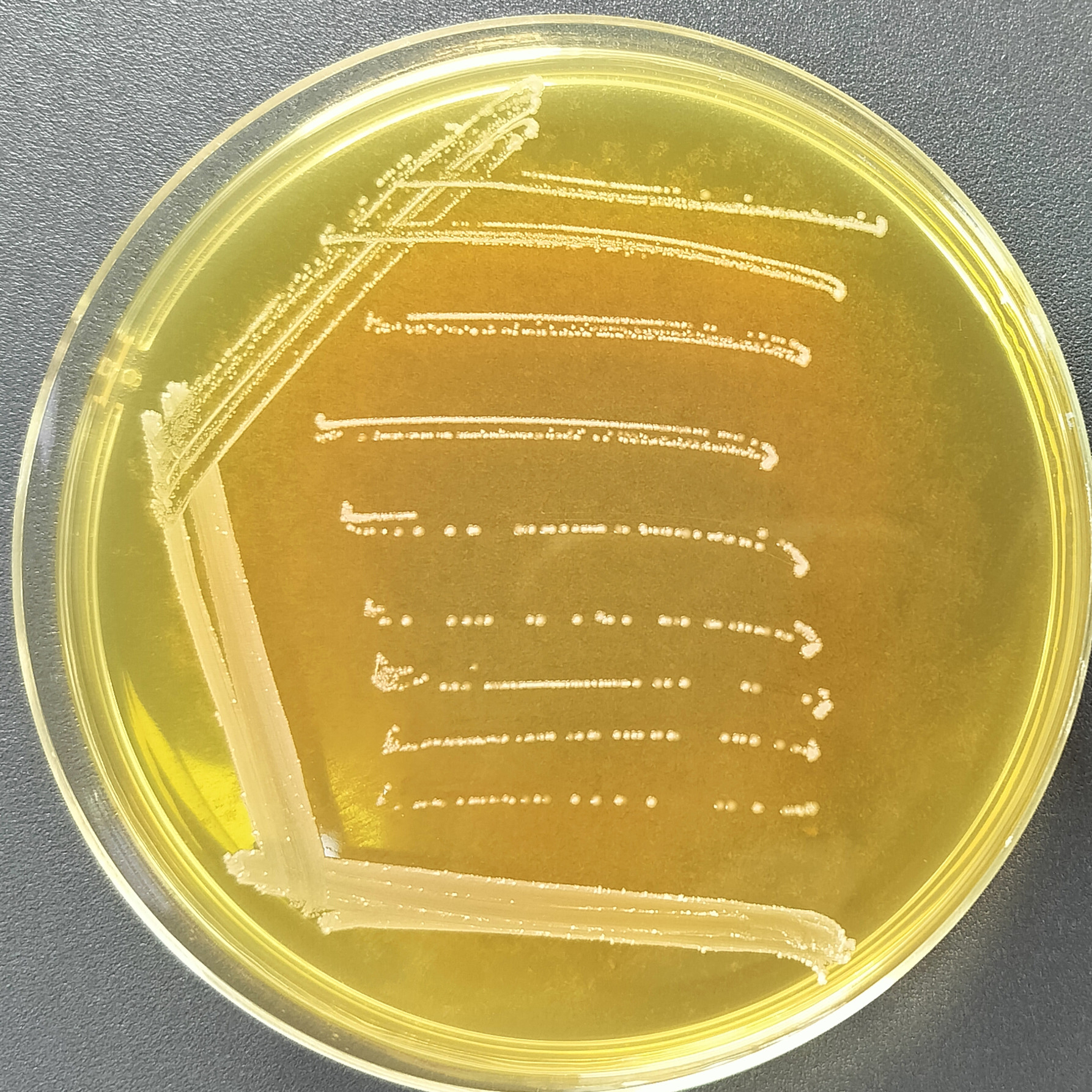 Bifidobacterium bifidum-BNCC