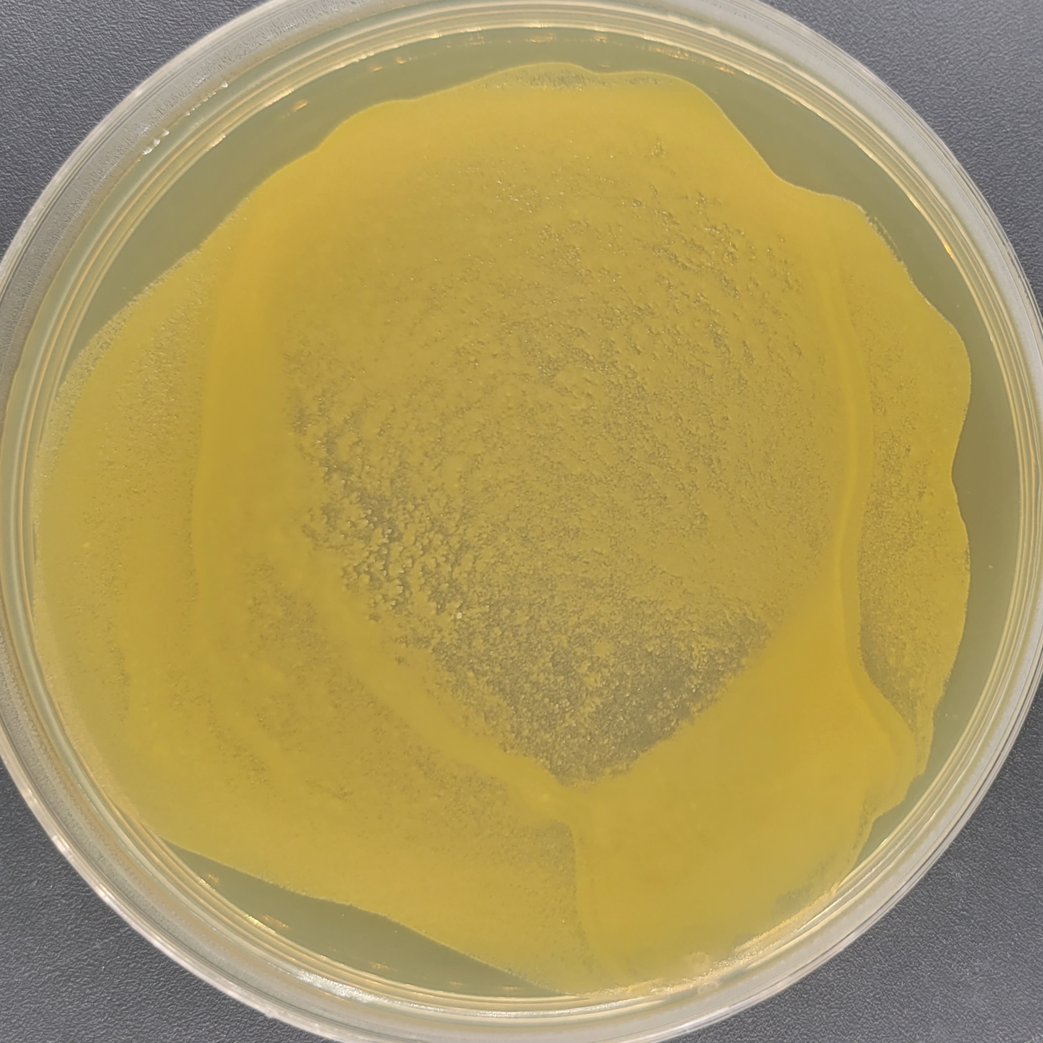 Pseudomonas aeruginosa-BNCC