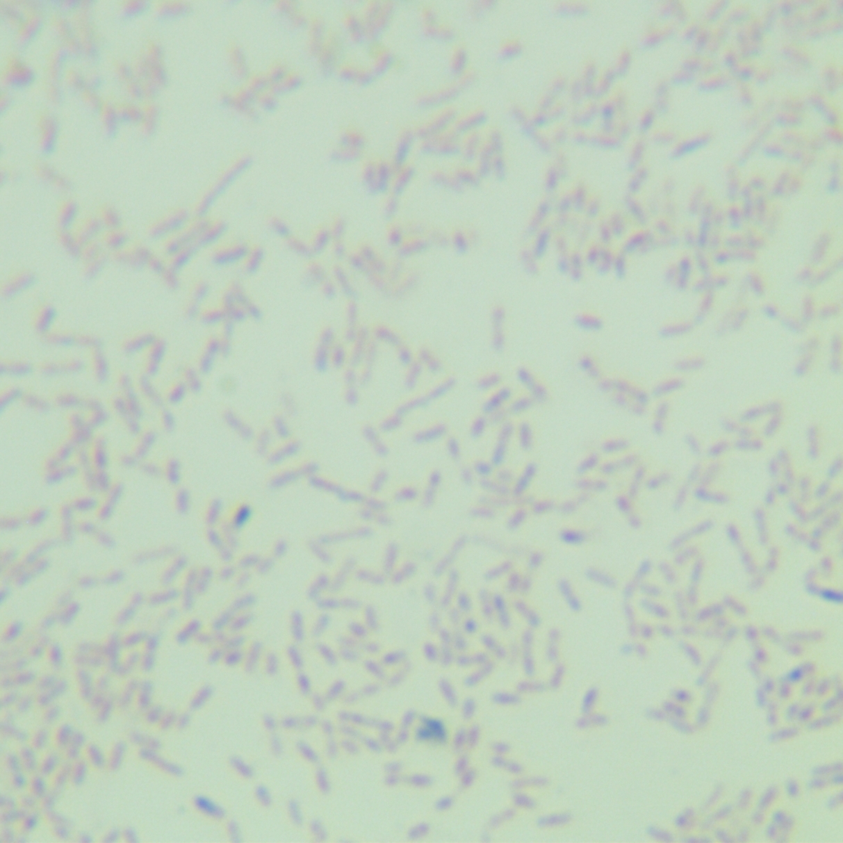 Pseudomonas aeruginosa-BNCC