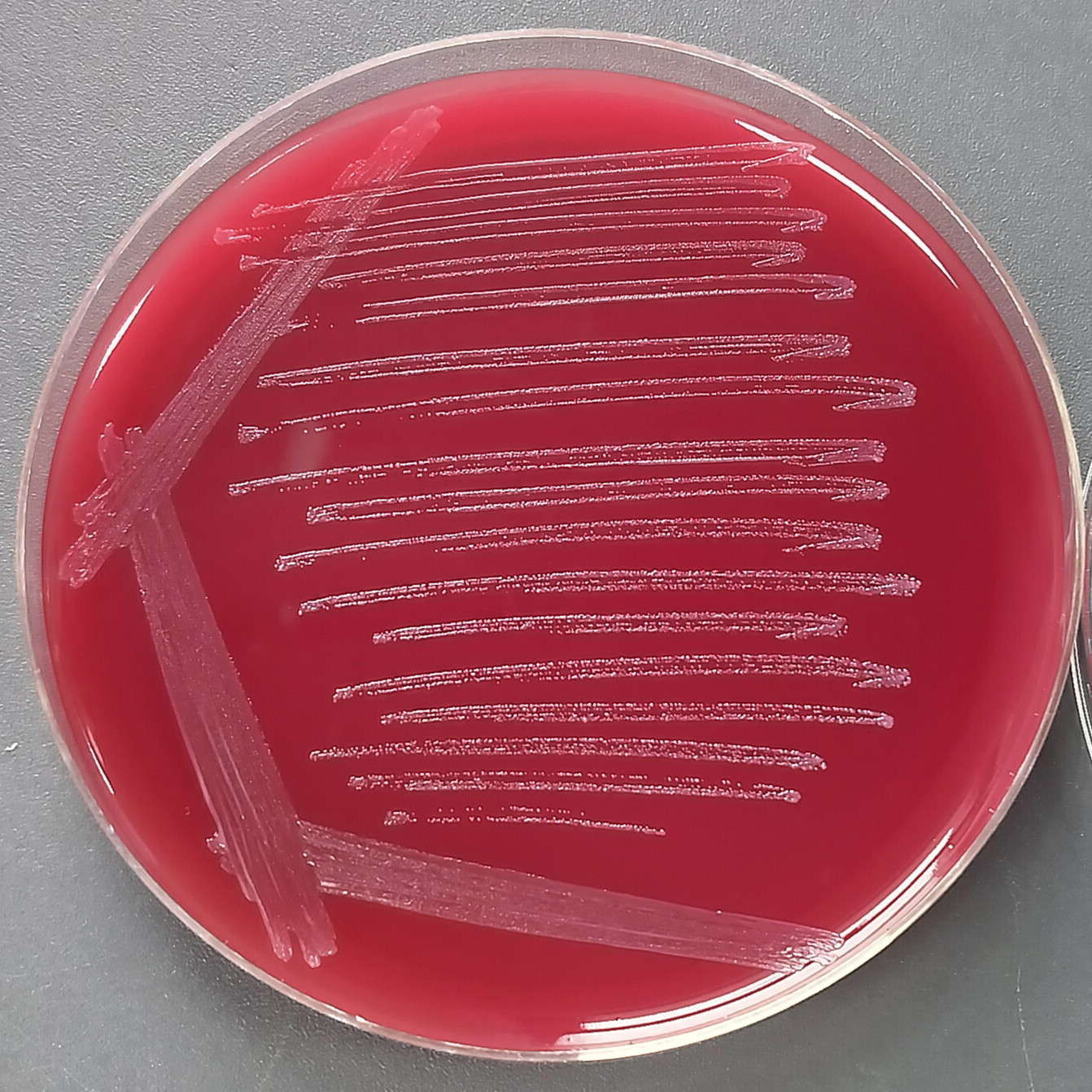 Bifidobacterium longum-BNCC