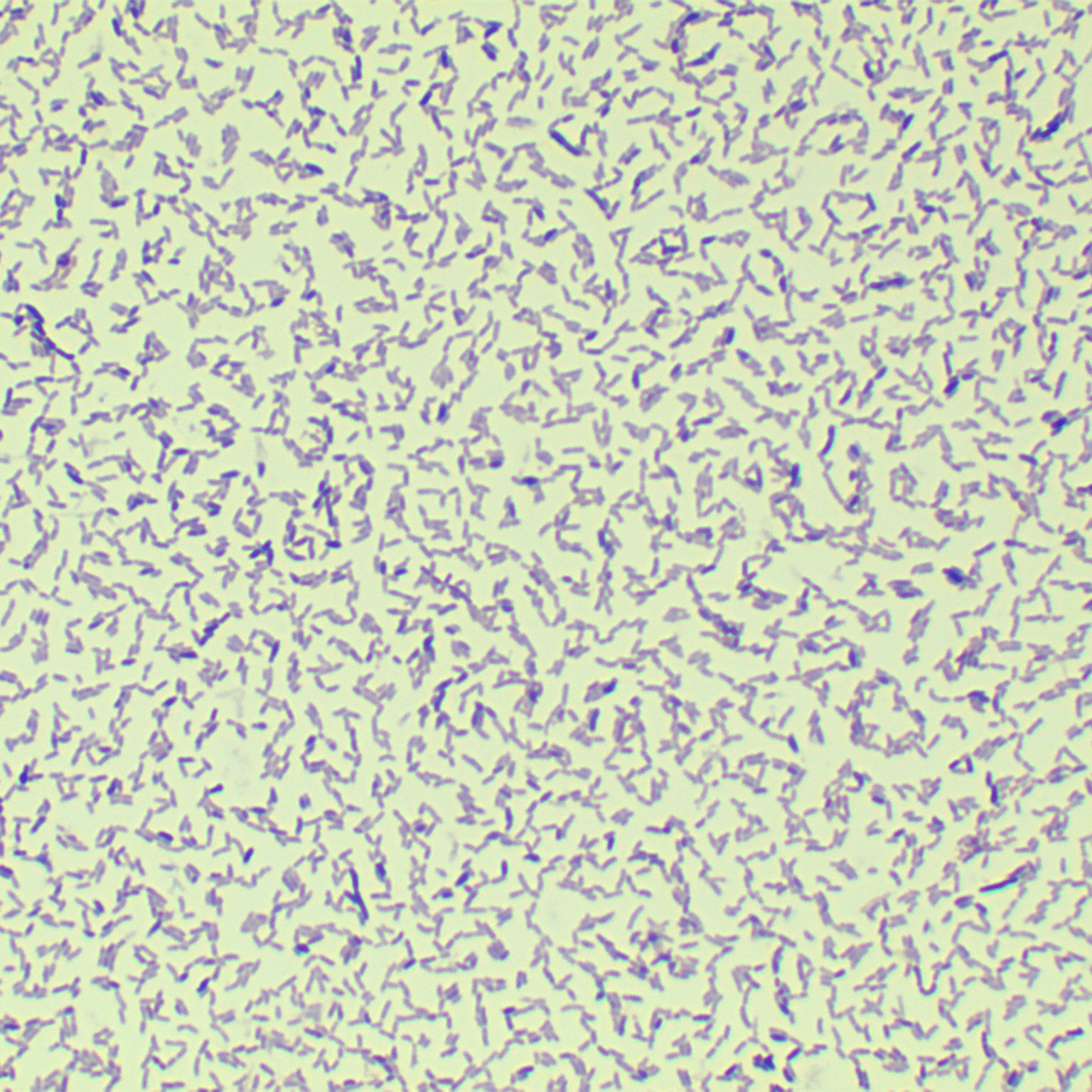 Bifidobacterium longum-BNCC