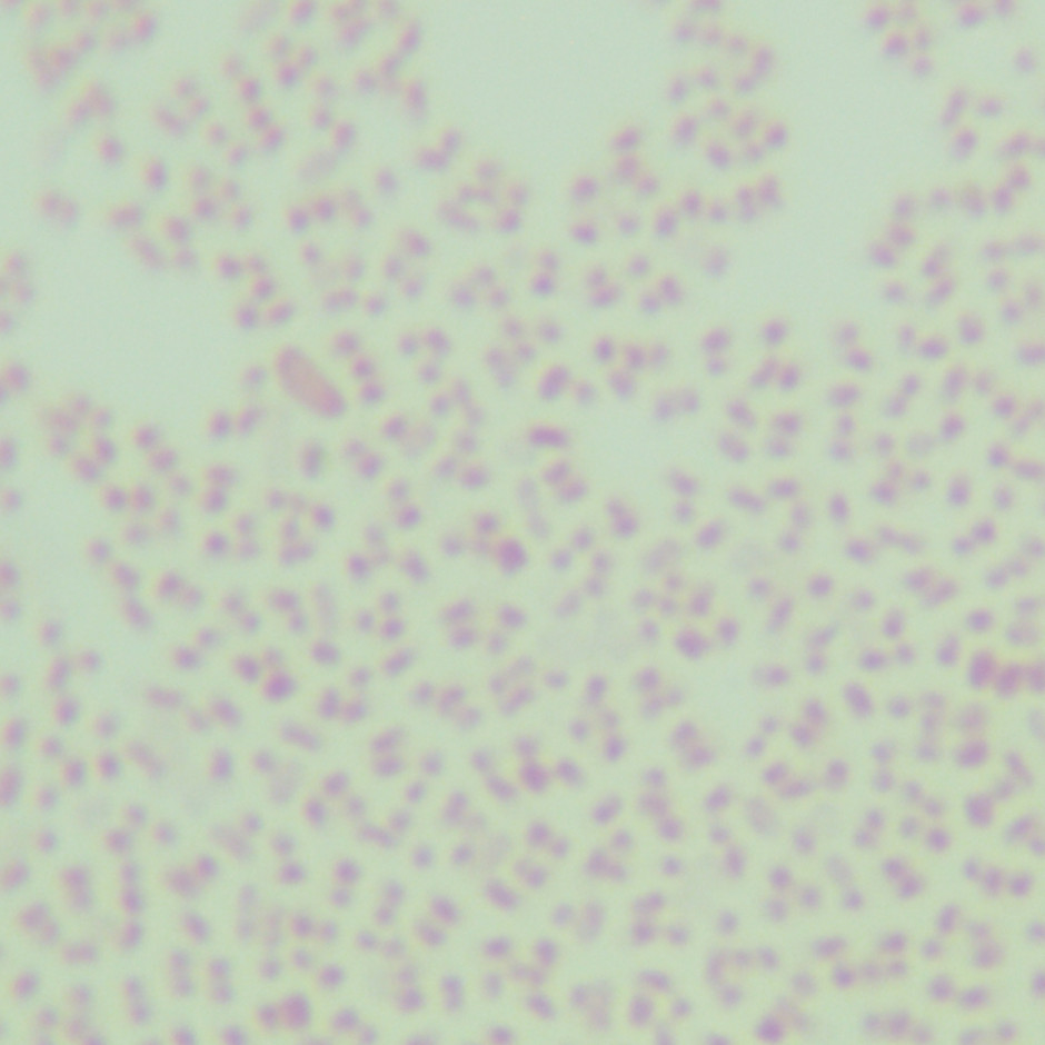 Escherichia coli-BNCC