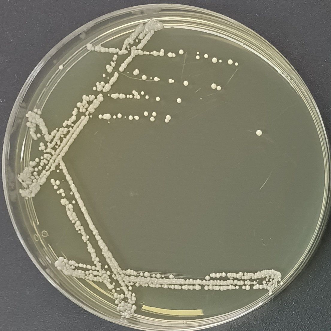 Saccharomyces cerevisiae-BNCC