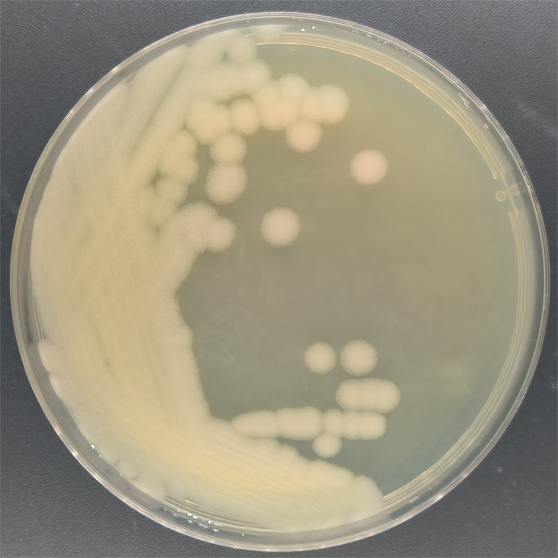 Bacillus cereus-BNCC