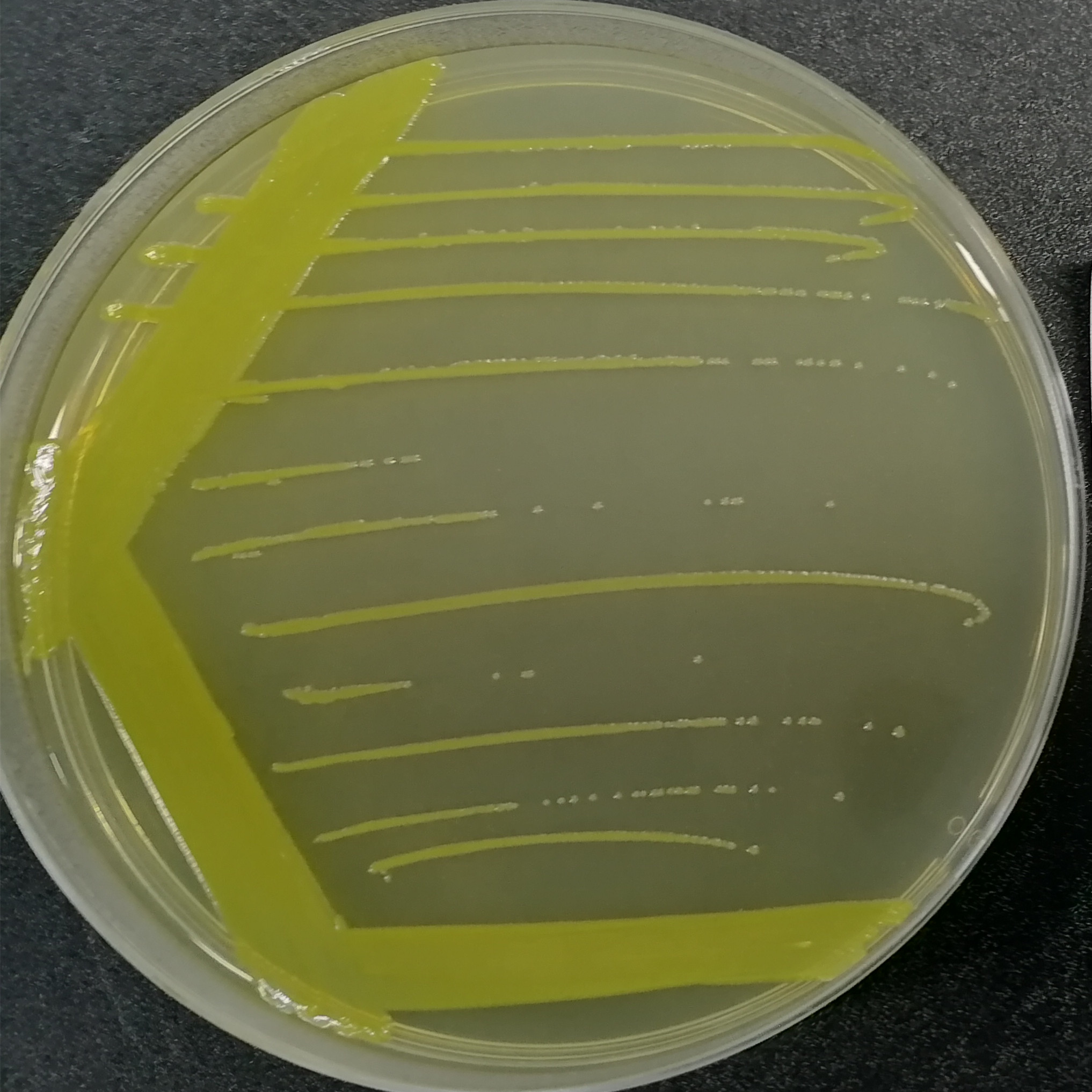 Burkholderia cepacia-BNCC