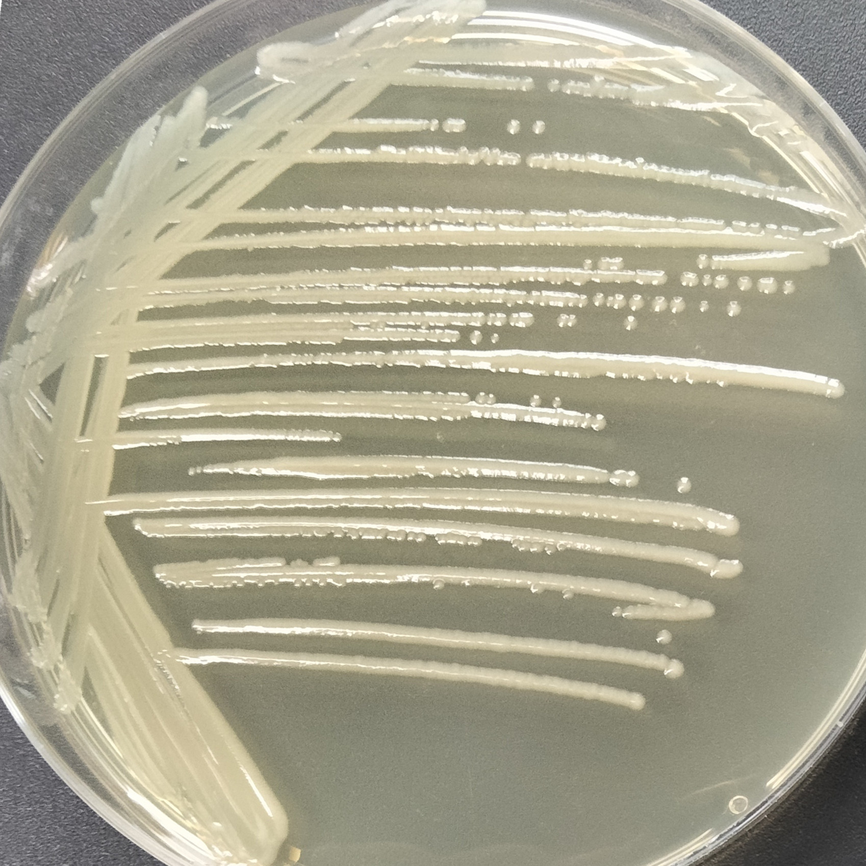 Escherichia coli-BNCC