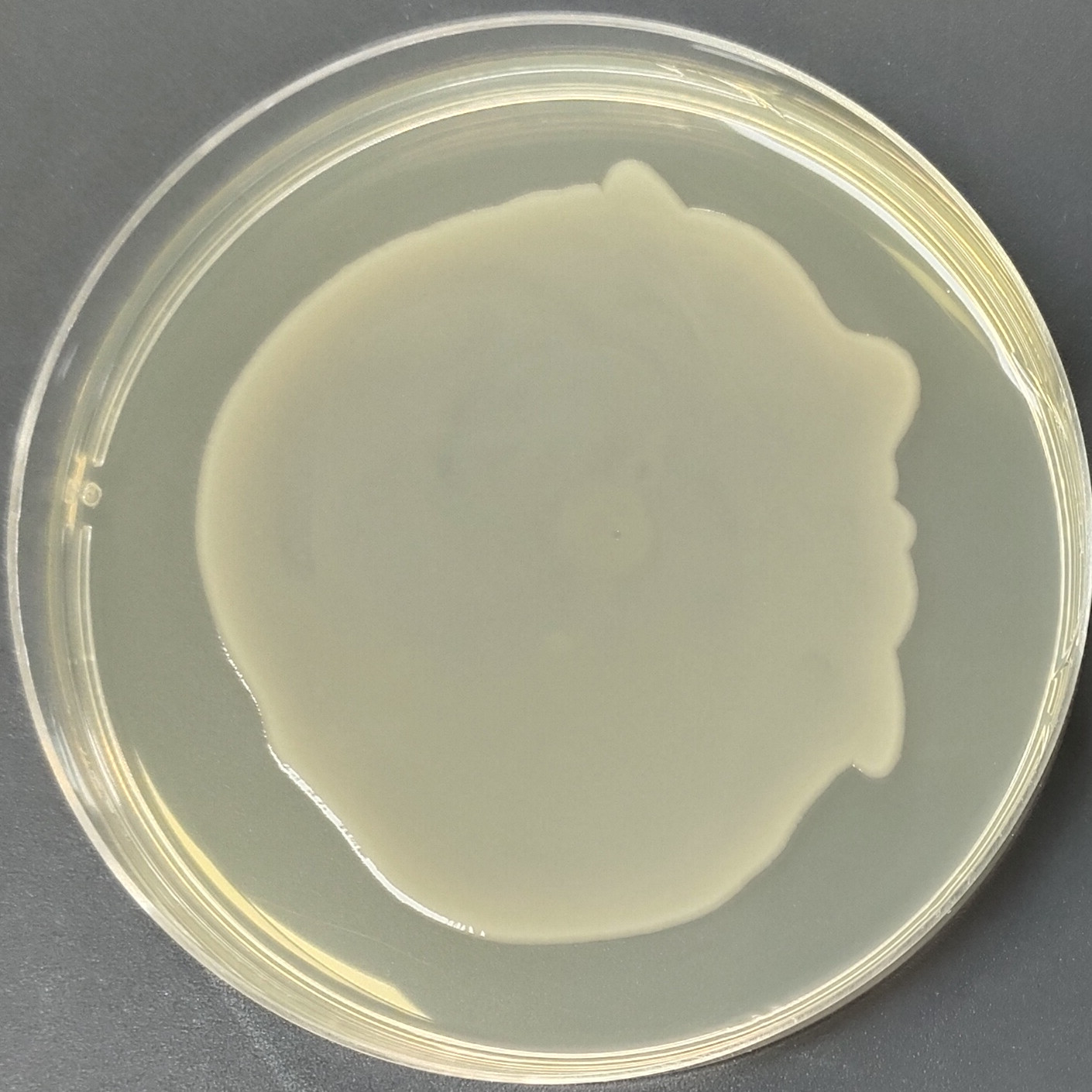 Enteropathogenic Escherichia coli-BNCC