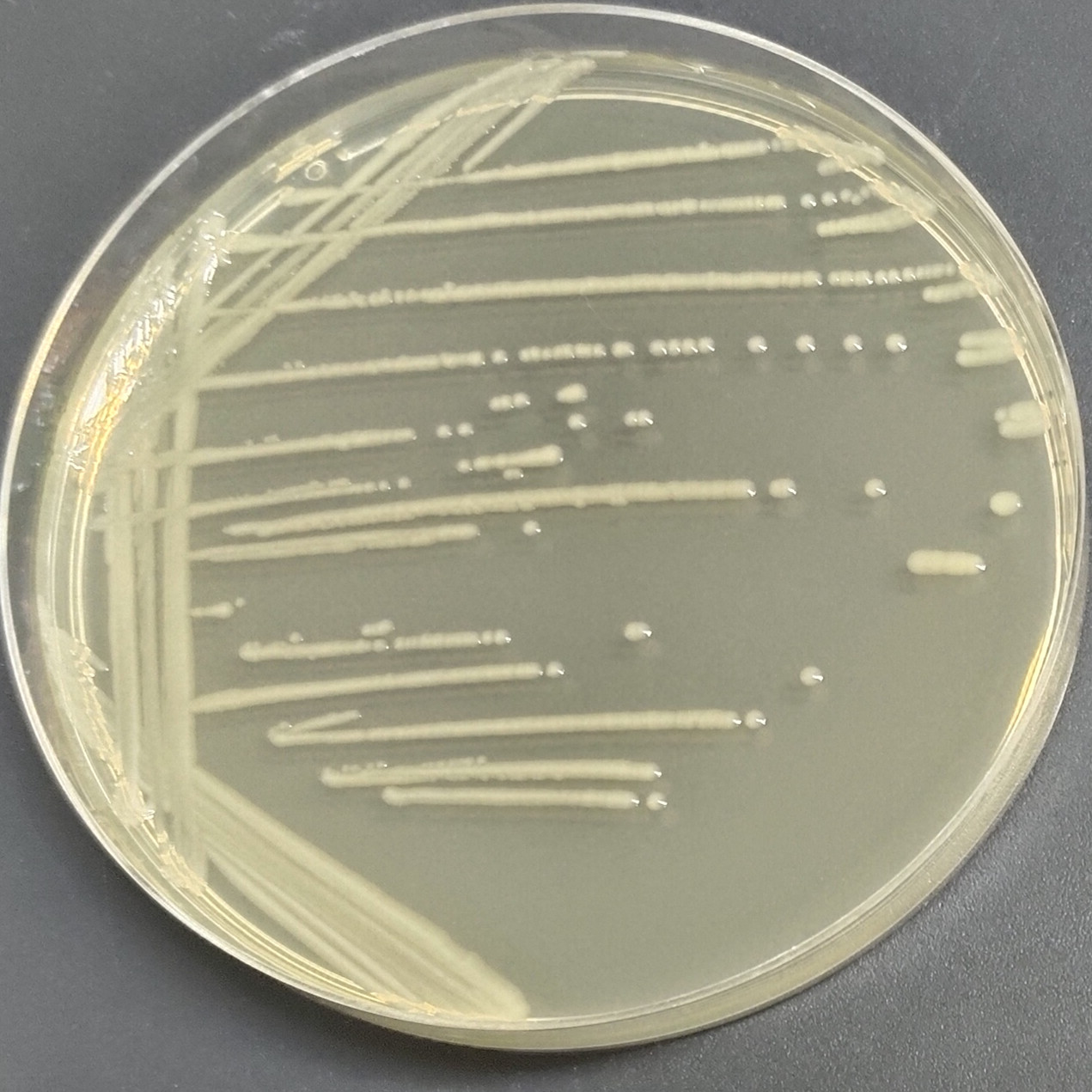 Shigella toxic Escherichia coli-BNCC
