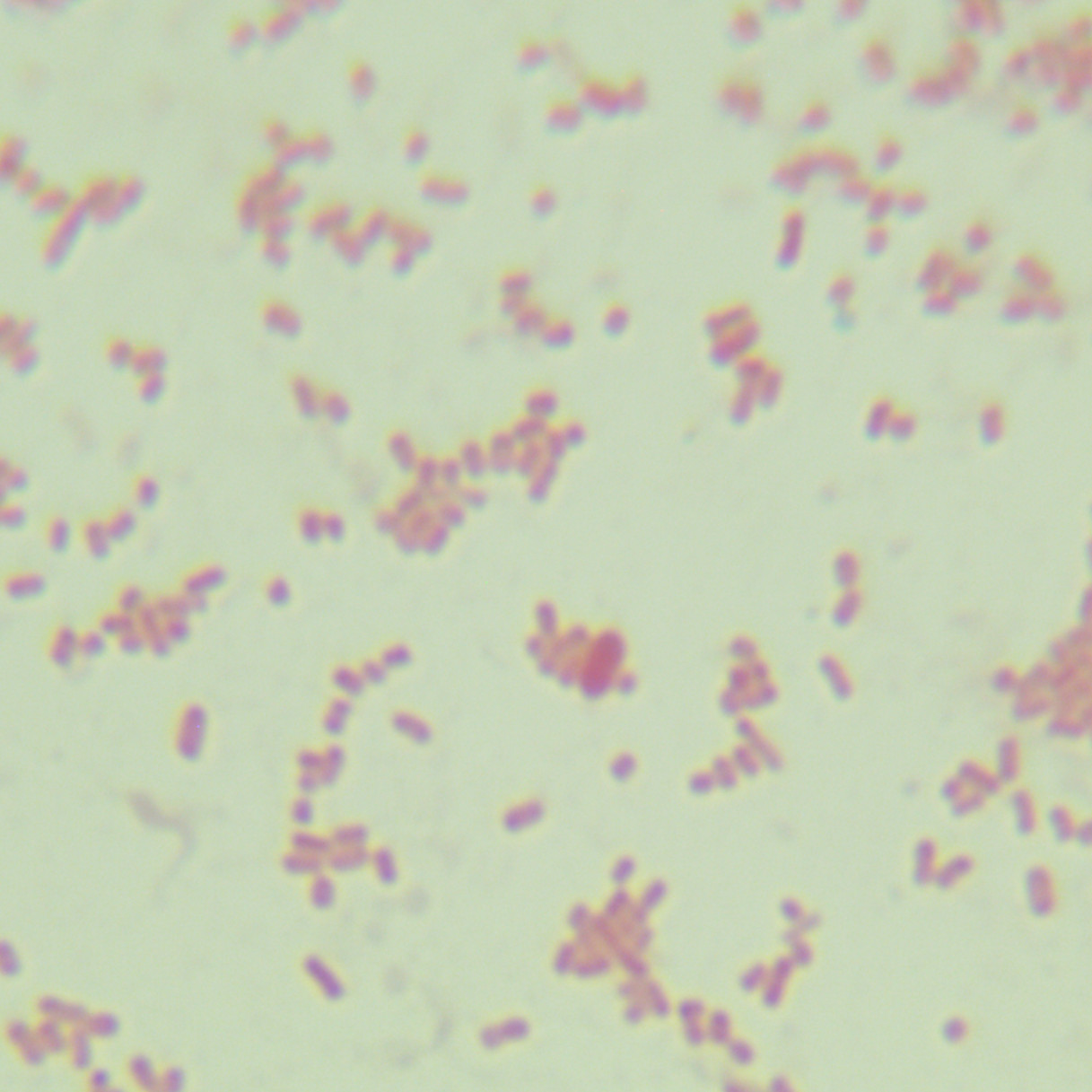 Shigella toxic Escherichia coli-BNCC