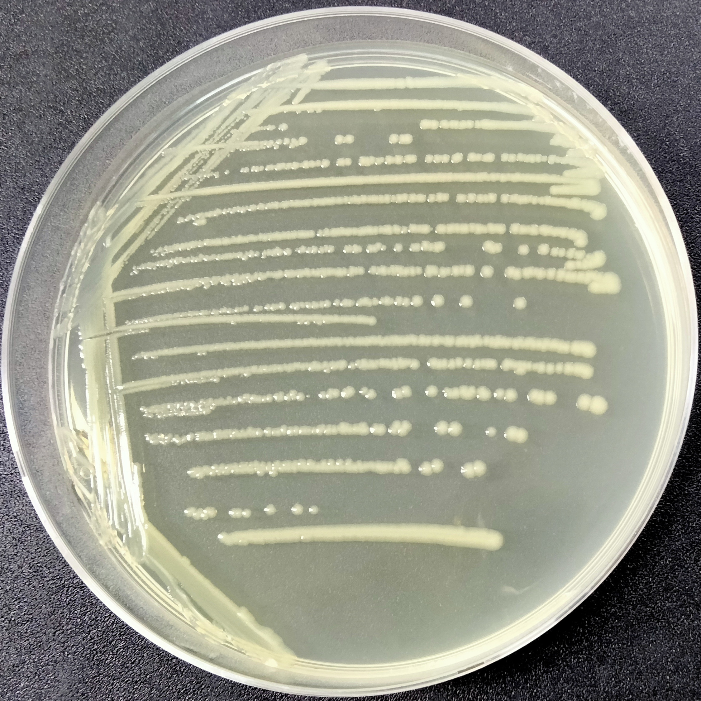 Shigella toxic Escherichia coli-BNCC