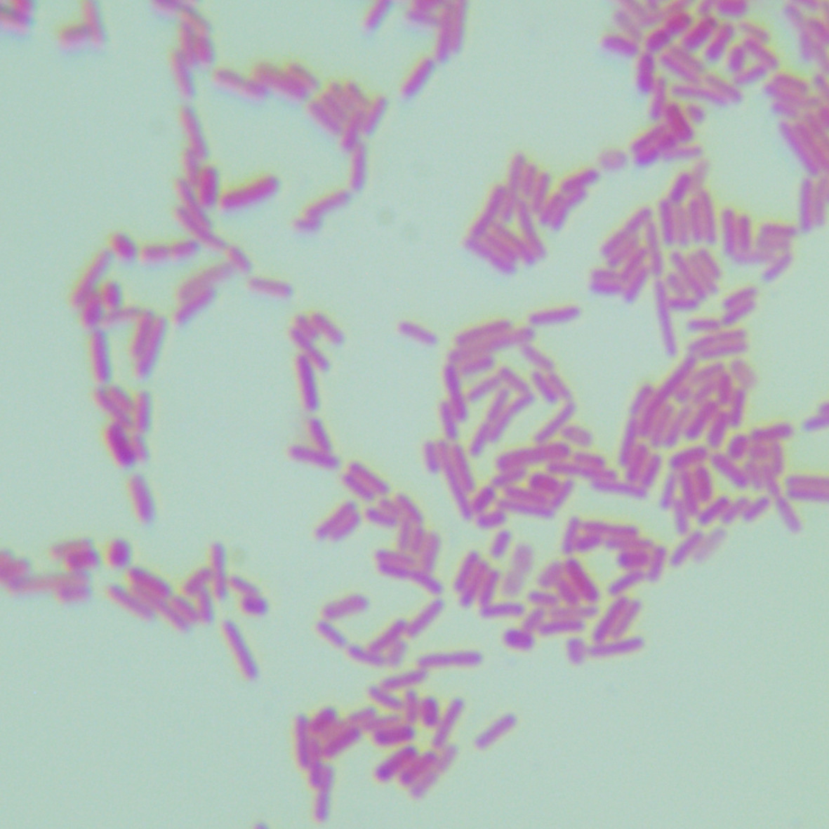 Shigella toxic Escherichia coli-BNCC