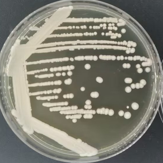 Baker's yeast-BNCC